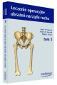 Leczenie operacyjne obrażeń narządu ruchu. Tom III + DVD