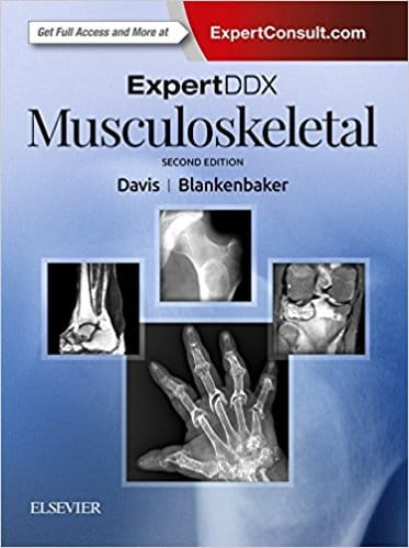 ExpertDDx Musculoskeletal, 2nd Edition.jpg