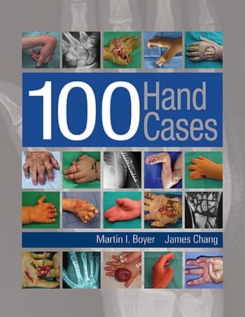 100 Hand Cases.jpg