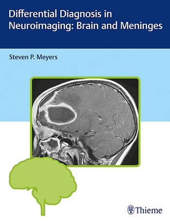 Differential Diagnosis in Neuroimaging Brain and Meninges.jpg