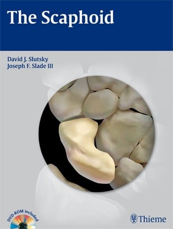 The Scaphoid.jpg