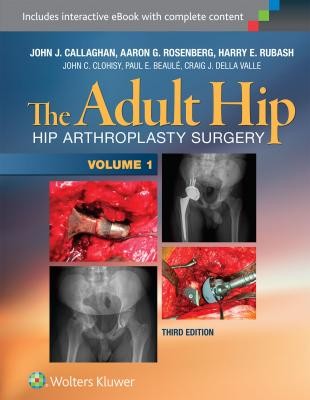 The Adult Hip (Two Volume Set), 3e.jpg