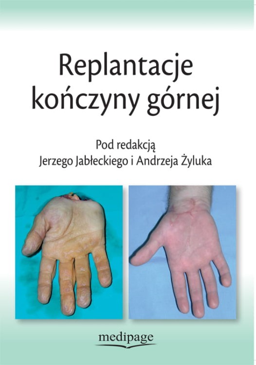 Replantacje - okladka.jpg