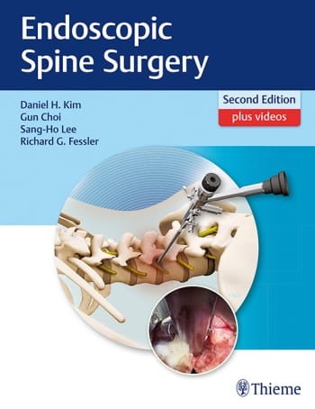 Endoscopic Spine Surgery.jpg