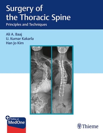 Surgery of the Thoracic Spine.jpg