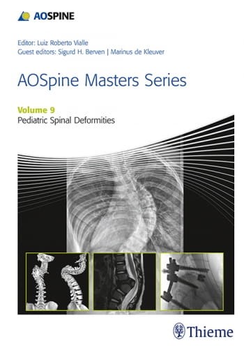 AOSpine Masters Series, Volume 9 Pediatric Spinal Deformities.jpg