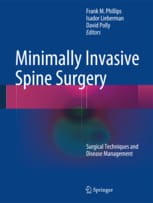 Minimally Invasive Spine Surgery.jpg