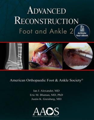 advanced_reconstruction_foot.jpg