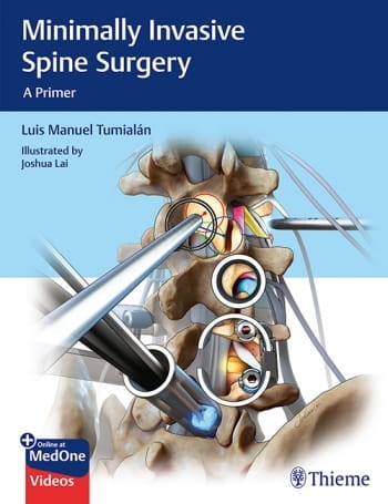 Minimally Invasive Spine Surgery.jpg