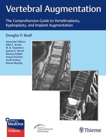 Vertebral Augmentation.jpg