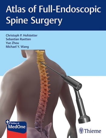 Atlas of Full-Endoscopic Spine Surgery.jpg