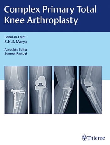Complex Primary Total Knee Arthroplasty.jpg