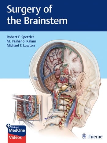 Surgery of the Brainstem.jpg