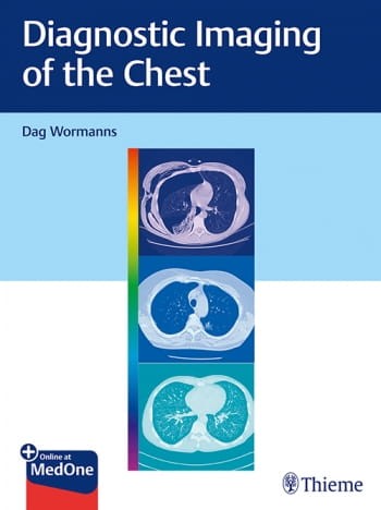 Diagnostic Imaging of the Chest.jpg