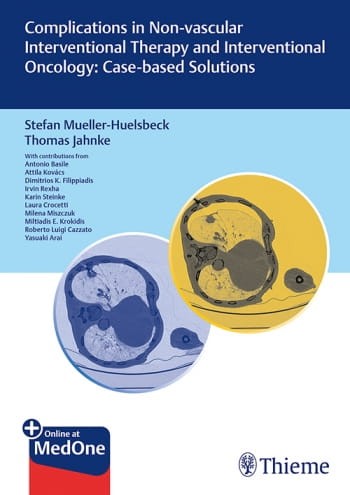Complications in Non-vascular Interventional Therapy and Interventional Oncology Case-based Solutions.jpg