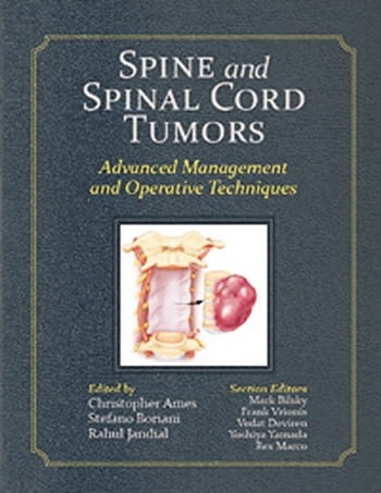 Spine and Spinal Cord Tumors.jpg