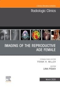 Imaging of the Reproductive Age Female,An Issue of Radiologic Clinics of North America, 1st Edition.jpg