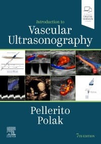 Introduction to Vascular Ultrasonography, 7th Edition.jpg