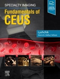 Specialty Imaging Fundamentals of CEUS, 1st Edition.jpg
