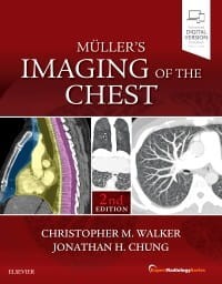 Muller's Imaging of the Chest, 2nd Edition.jpg
