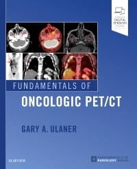 Fundamentals of Oncologic PETCT, 1st Edition.jpg