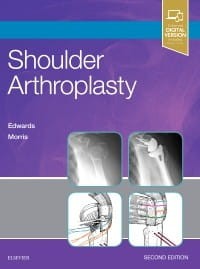 Shoulder Arthroplasty, 2nd Edition.jpg