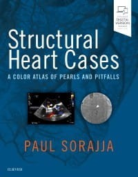 Structural Heart Cases, 1st Edition.jpg