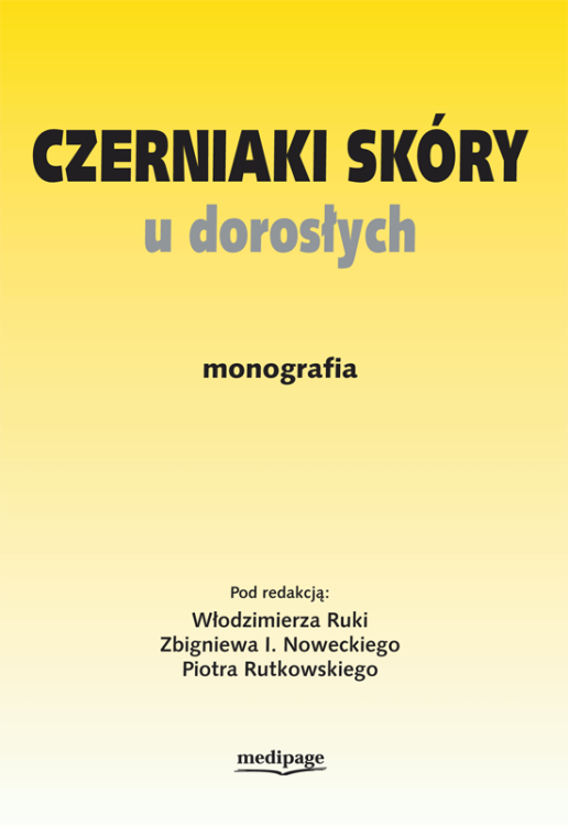 Czerniaki skóry u dorosłych.png