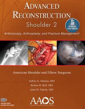Advanced Reconstruction Shoulder 2 Print + Ebook with Multimedia.jpg