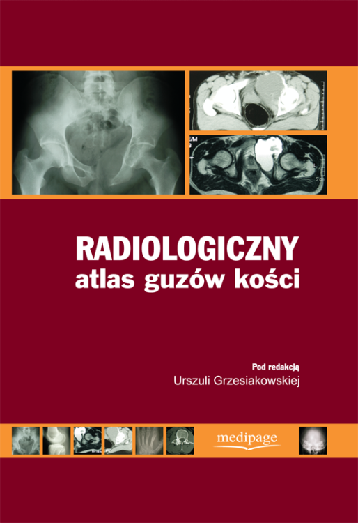 okladka_Radiologiczny atlas guzow kosci.png
