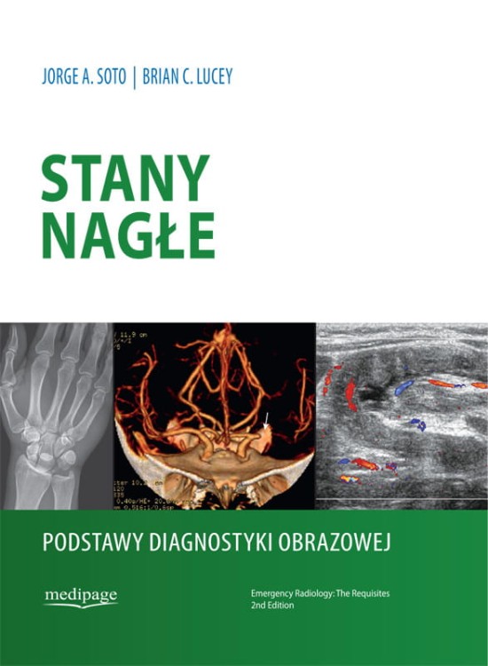 Soto_Stany nagle_oklejka_g.27_druk_02.2023.jpg