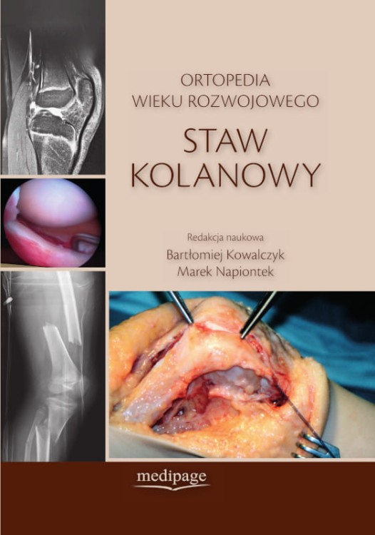 Staw kolanowy - okladka - poprawiona.jpg