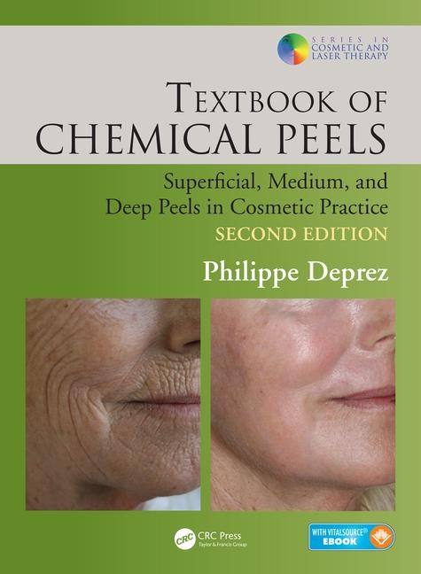 Textbook of Chemical Peels, Second Edition.jpg