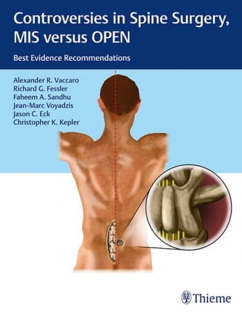 Controversies in Spine Surgery, MIS versus OPEN.jpg