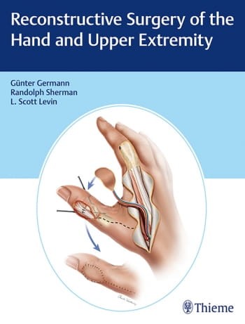 Reconstructive Surgery of the Hand and Upper Extremity.jpg
