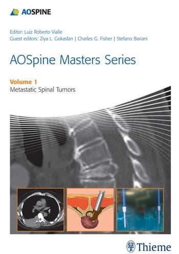 AOSpine Masters Series Volume 1.jpg