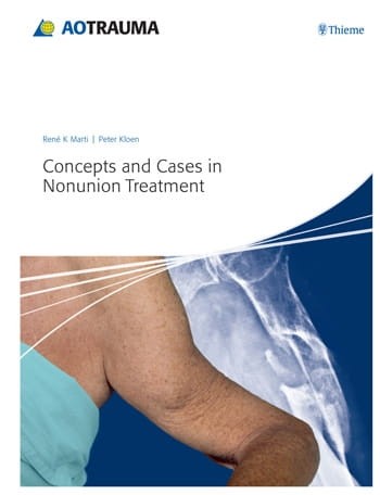 Concepts and Cases in Nonunion Treatment.jpg