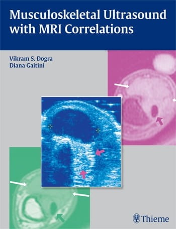 Musculoskeletal Ultrasound with MRI Correlations.jpg