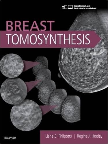 Breast Tomosynthesis, 1st Edition.jpg