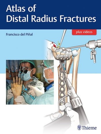 Atlas of Distal Radius Fractures.jpg