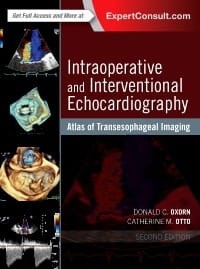 Intraoperative and Interventional Echocardiography, 2nd Edition.jpg