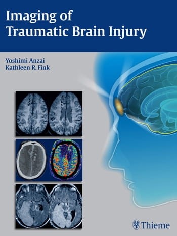 Imaging of Traumatic Brain Injury.jpg