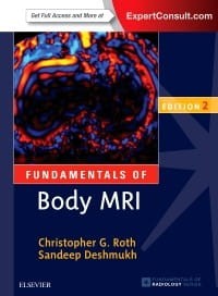 Fundamentals of Body MRI, 2nd Edition.jpg