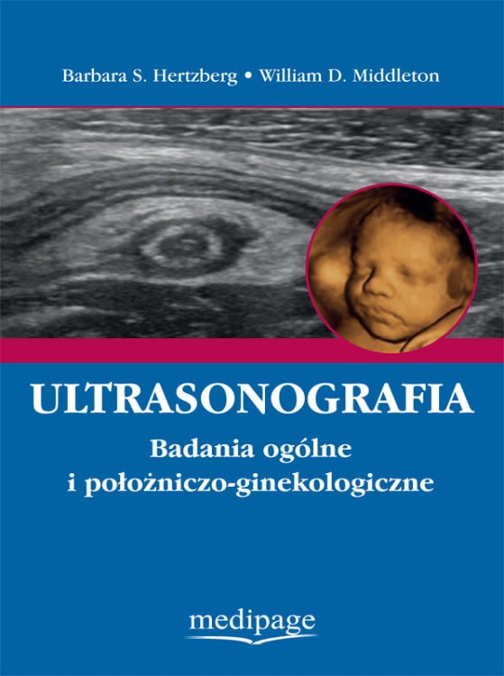 Hertzberg_okładka przód.jpg