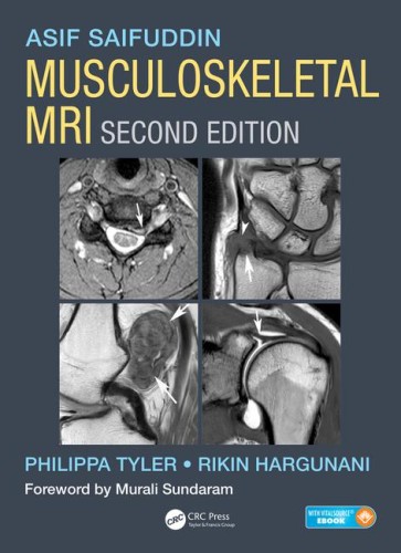 Musculoskeletal MRI, Second Edition.jpg