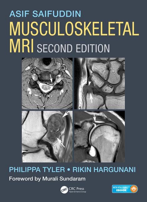 Musculoskeletal MRI, Second Edition.jpg