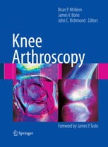 Knee Arthroscopy.jpg