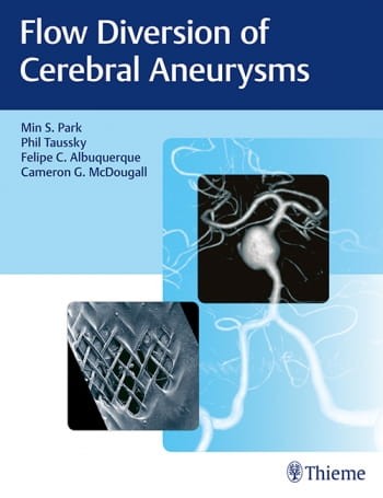 Flow Diversion of Cerebral Aneurysms.jpg