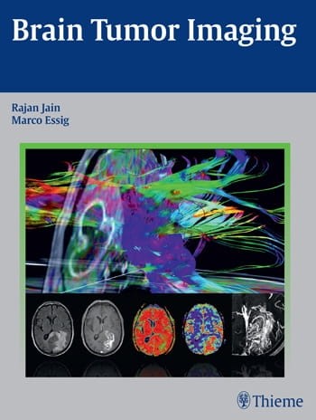 Brain Tumor Imaging.jpg