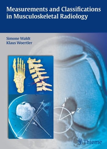 Measurements and Classifications in Musculoskeletal Radiology.jpg